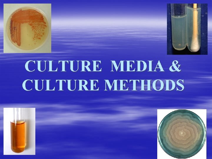 CULTURE MEDIA & CULTURE METHODS 