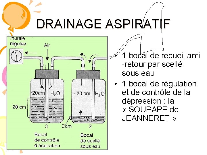 DRAINAGE ASPIRATIF • 1 bocal de recueil anti -retour par scellé sous eau •