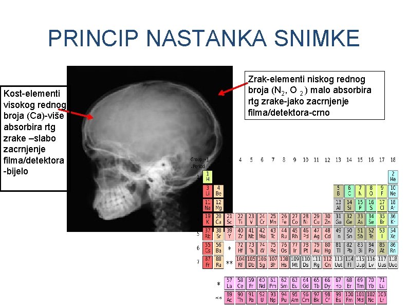 PRINCIP NASTANKA SNIMKE Kost-elementi visokog rednog broja (Ca)-više absorbira rtg zrake –slabo zacrnjenje filma/detektora