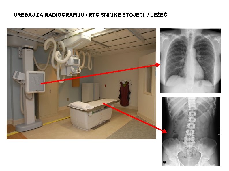 UREĐAJ ZA RADIOGRAFIJU / RTG SNIMKE STOJEĆI / LEŽEĆI 