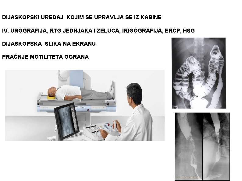 DIJASKOPSKI UREĐAJ KOJIM SE UPRAVLJA SE IZ KABINE IV. UROGRAFIJA, RTG JEDNJAKA I ŽELUCA,