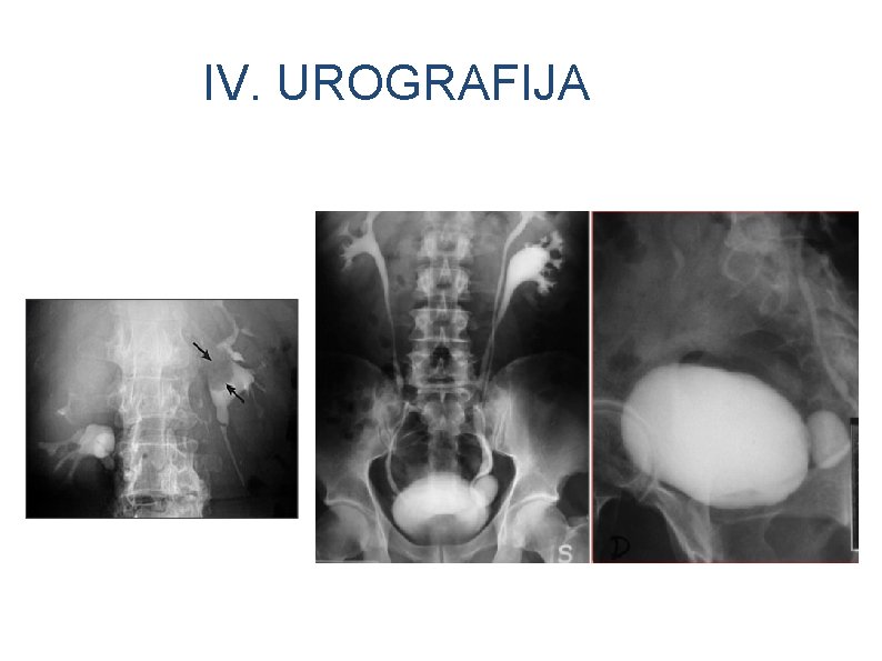 IV. UROGRAFIJA 