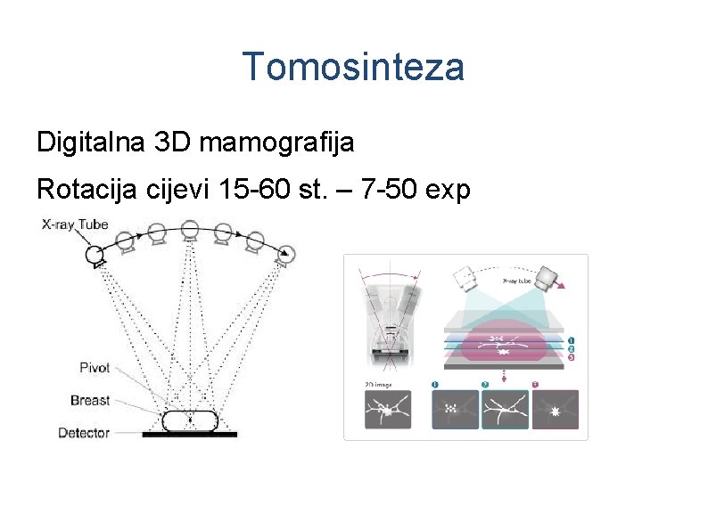 Tomosinteza Digitalna 3 D mamografija Rotacija cijevi 15 -60 st. – 7 -50 exp