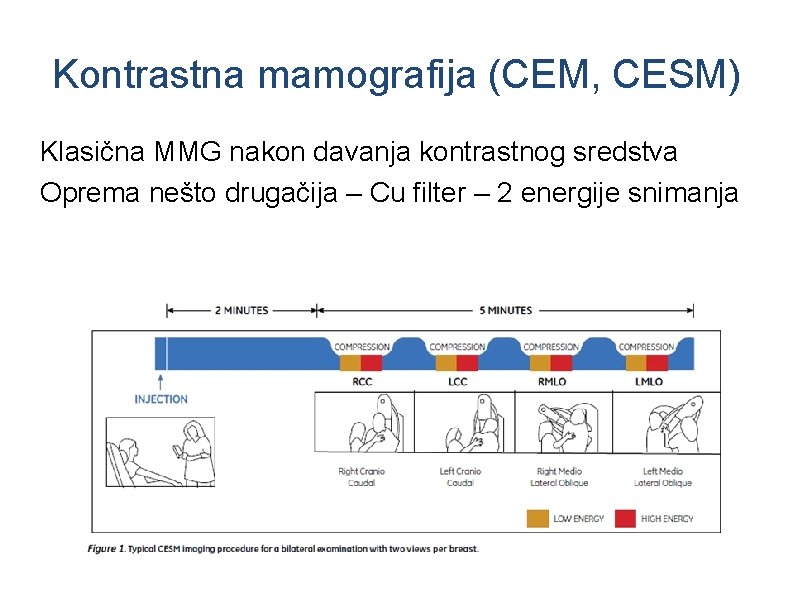 Kontrastna mamografija (CEM, CESM) Klasična MMG nakon davanja kontrastnog sredstva Oprema nešto drugačija –