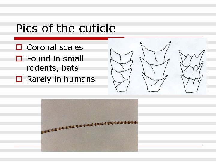 Pics of the cuticle o Coronal scales o Found in small rodents, bats o