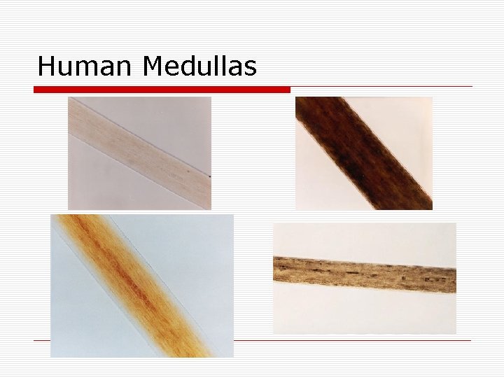 Human Medullas 