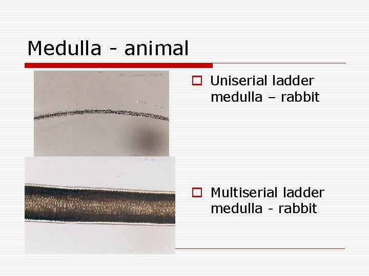 Medulla - animal o Uniserial ladder medulla – rabbit o Multiserial ladder medulla -