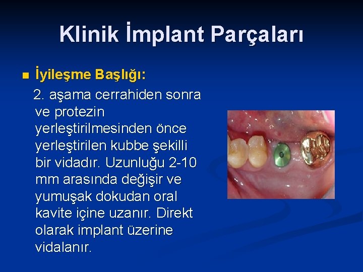 Klinik İmplant Parçaları n İyileşme Başlığı: 2. aşama cerrahiden sonra ve protezin yerleştirilmesinden önce