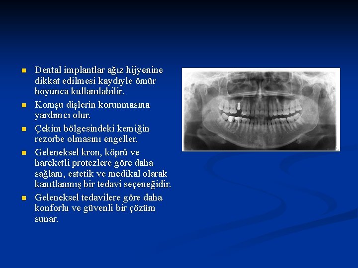 n n n Dental implantlar ağız hijyenine dikkat edilmesi kaydıyle ömür boyunca kullanılabilir. Komşu