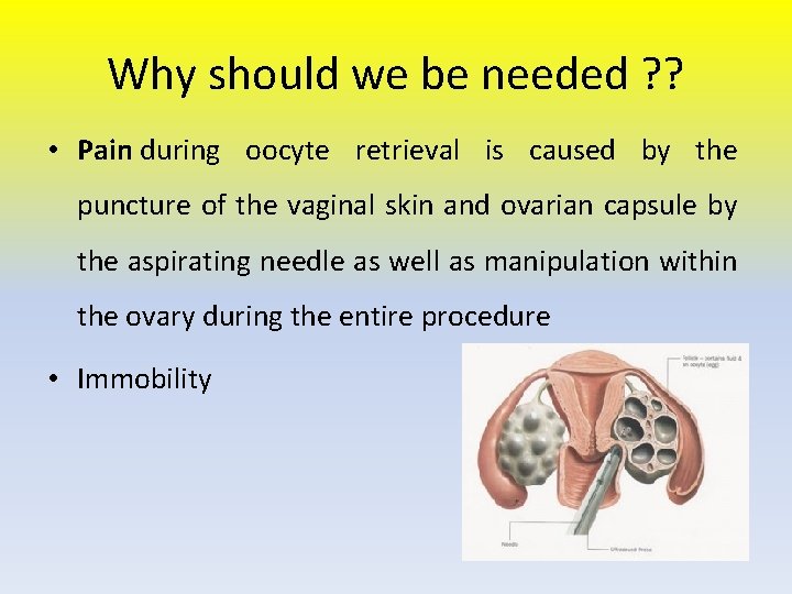 Why should we be needed ? ? • Pain during oocyte retrieval is caused