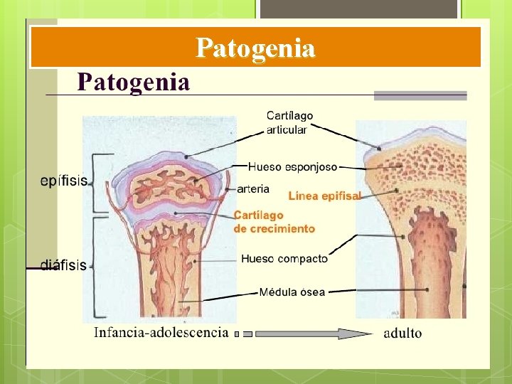 Patogenia Patogenia