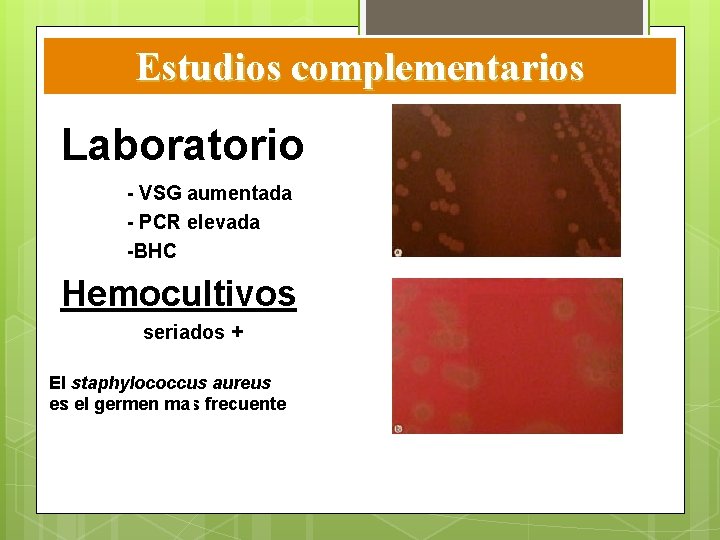 Estudios complementarios Laboratorio - VSG aumentada - PCR elevada -BHC Hemocultivos seriados + El Estudios complementarios Laboratorio - VSG aumentada - PCR elevada -BHC Hemocultivos seriados + El