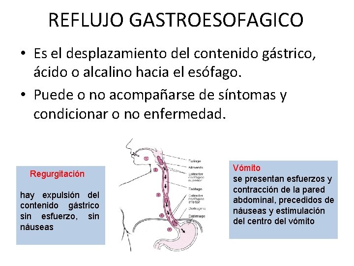 REFLUJO GASTROESOFAGICO • Es el desplazamiento del contenido gástrico, ácido o alcalino hacia el