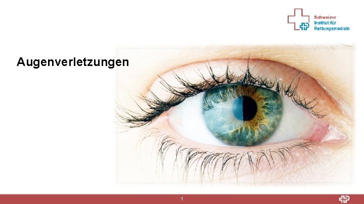 Verätzung Auge Wann Zum Arzt slidetodoc.com