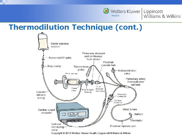 Thermodilution Technique (cont. ) Copyright © 2013 Wolters Kluwer Health | Lippincott Williams &