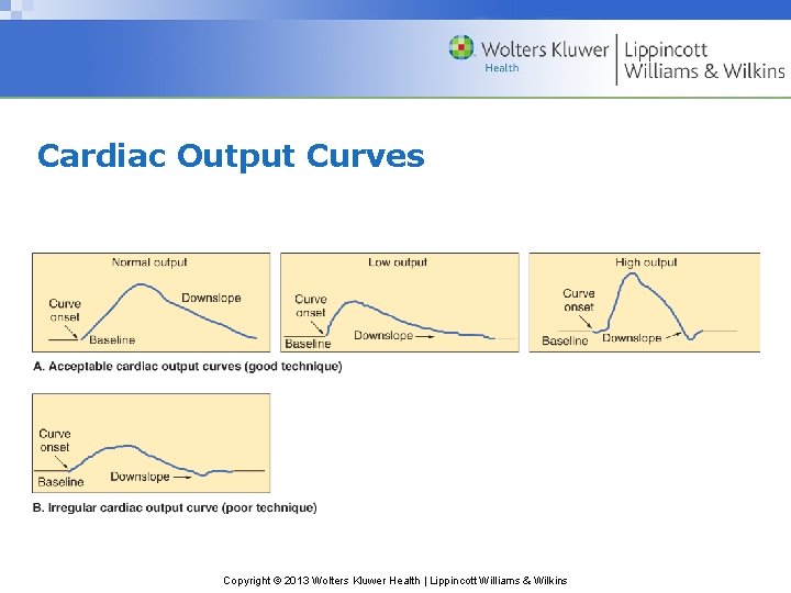 Cardiac Output Curves Copyright © 2013 Wolters Kluwer Health | Lippincott Williams & Wilkins