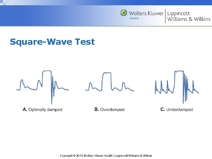 Square-Wave Test Copyright © 2013 Wolters Kluwer Health | Lippincott Williams & Wilkins 