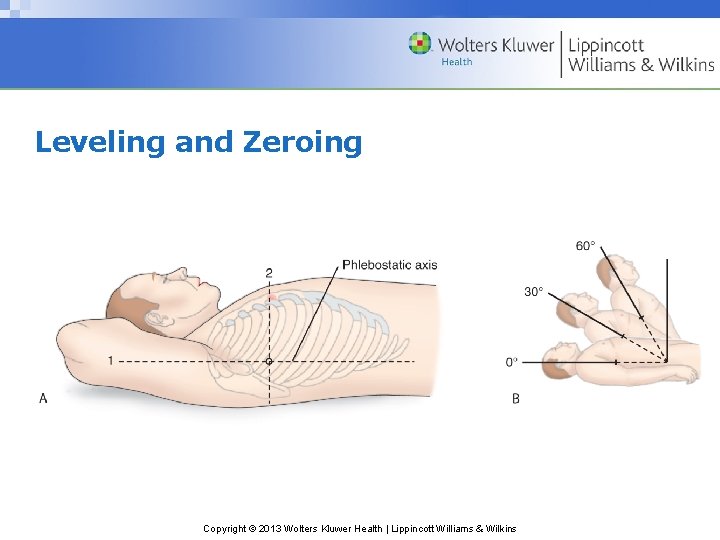 Leveling and Zeroing Copyright © 2013 Wolters Kluwer Health | Lippincott Williams & Wilkins