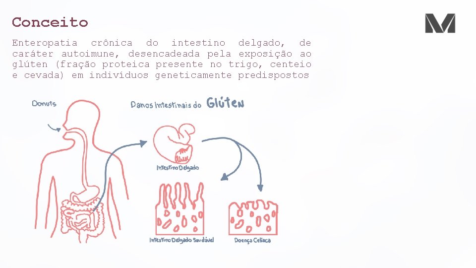 Conceito Enteropatia crônica do intestino delgado, de caráter autoimune, desencadeada pela exposição ao glúten