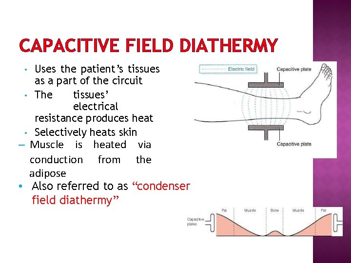 CAPACITIVE FIELD DIATHERMY • • • Uses the patient’s tissues as a part of