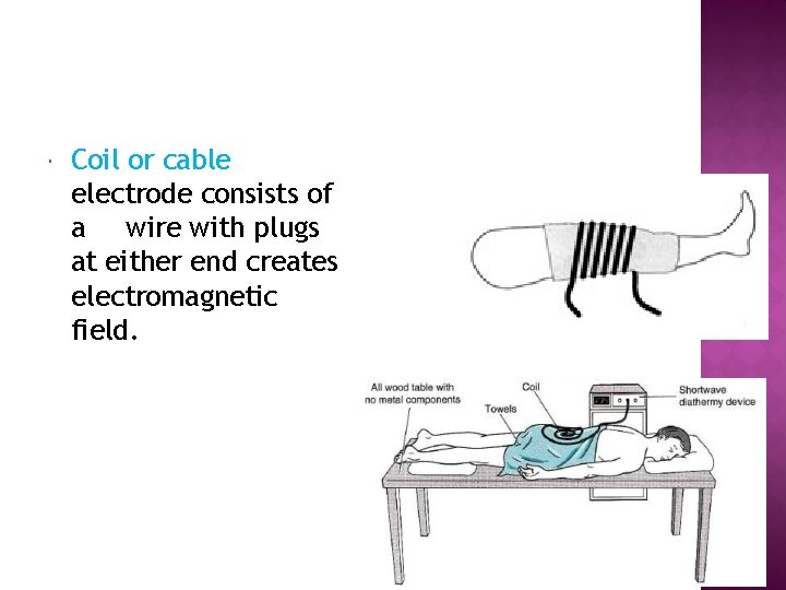  Coil or cable electrode consists of a wire with plugs at either end