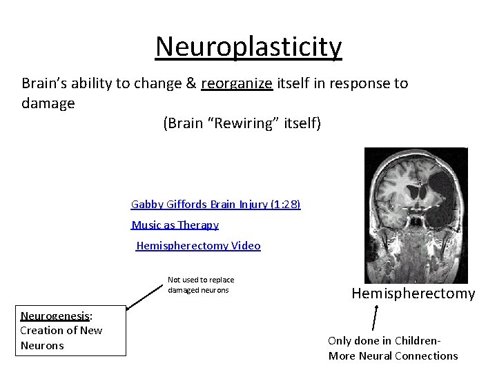 Neuroplasticity Brain’s ability to change & reorganize itself in response to damage (Brain “Rewiring”