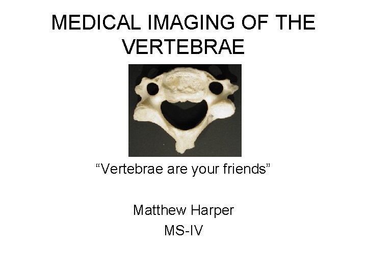 MEDICAL IMAGING OF THE VERTEBRAE “Vertebrae are your friends” Matthew Harper MS-IV 