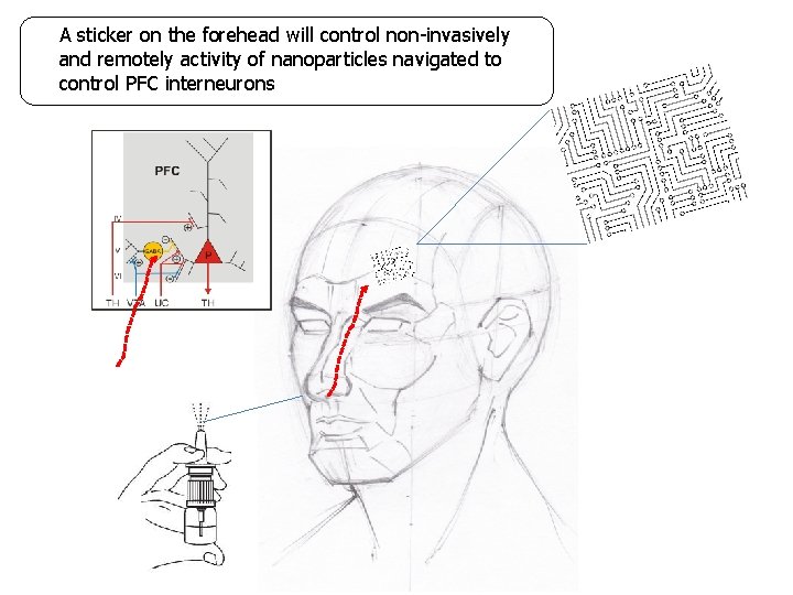 A sticker on the forehead will control non-invasively and remotely activity of nanoparticles navigated