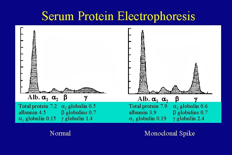 Serum Protein Electrophoresis Alb. a 1 a 2 b g Total protein 7. 2