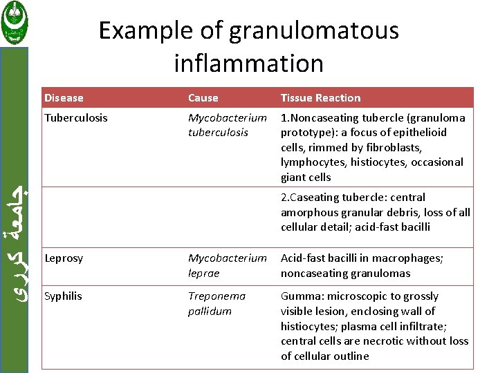  ﺟﺎﻣﻌﺔ ﻛﺮﺭﻱ Example of granulomatous inflammation Disease Cause Tissue Reaction Tuberculosis Mycobacterium tuberculosis