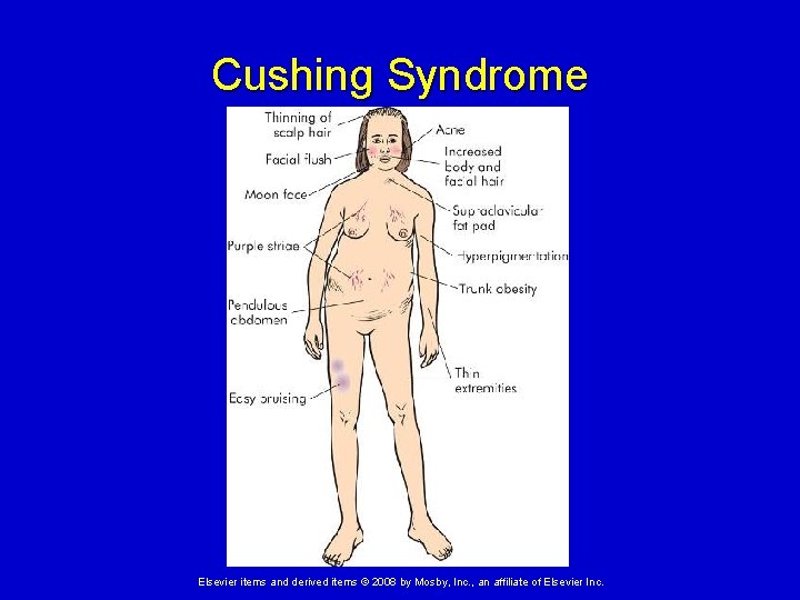 Cushing Syndrome Elsevier items and derived items © 2008 by Mosby, Inc. , an