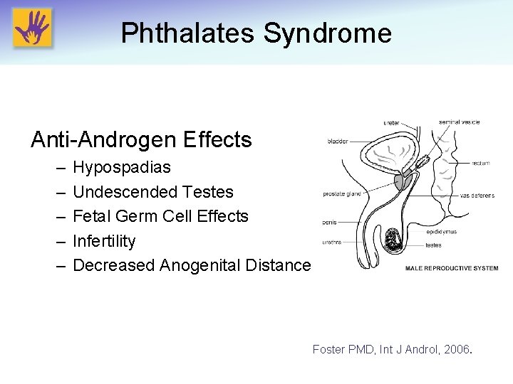 Phthalates Syndrome Anti-Androgen Effects – – – Hypospadias Undescended Testes Fetal Germ Cell Effects