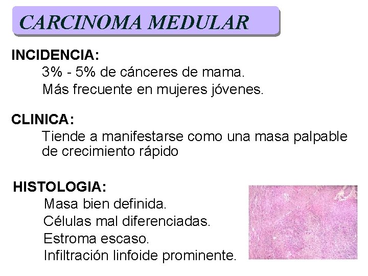 CARCINOMA MEDULAR INCIDENCIA: 3% - 5% de cánceres de mama. Más frecuente en mujeres CARCINOMA MEDULAR INCIDENCIA: 3% - 5% de cánceres de mama. Más frecuente en mujeres