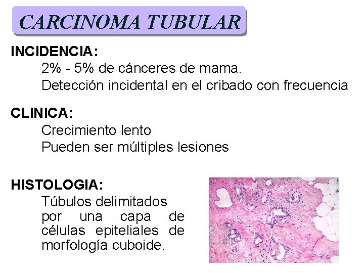 CARCINOMA TUBULAR INCIDENCIA: 2% - 5% de cánceres de mama. Detección incidental en el CARCINOMA TUBULAR INCIDENCIA: 2% - 5% de cánceres de mama. Detección incidental en el