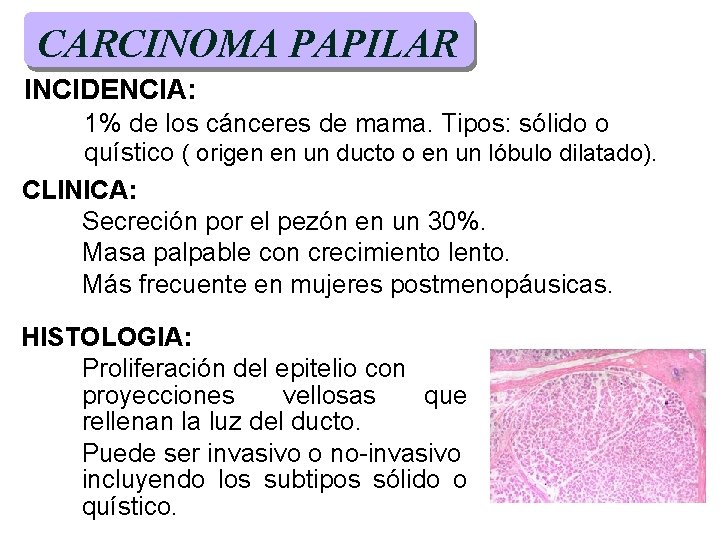 CARCINOMA PAPILAR INCIDENCIA: 1% de los cánceres de mama. Tipos: sólido o quístico ( CARCINOMA PAPILAR INCIDENCIA: 1% de los cánceres de mama. Tipos: sólido o quístico (