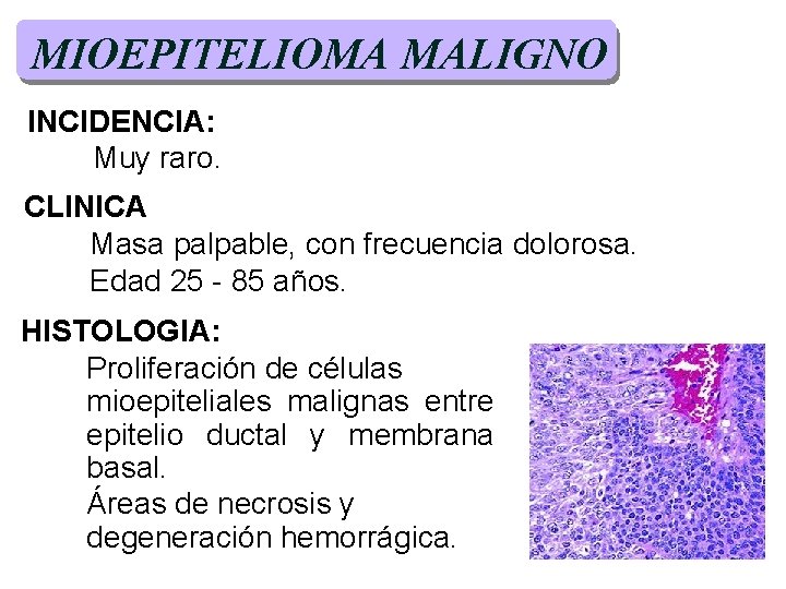 MIOEPITELIOMA MALIGNO INCIDENCIA: Muy raro. CLINICA Masa palpable, con frecuencia dolorosa. Edad 25 - MIOEPITELIOMA MALIGNO INCIDENCIA: Muy raro. CLINICA Masa palpable, con frecuencia dolorosa. Edad 25 -