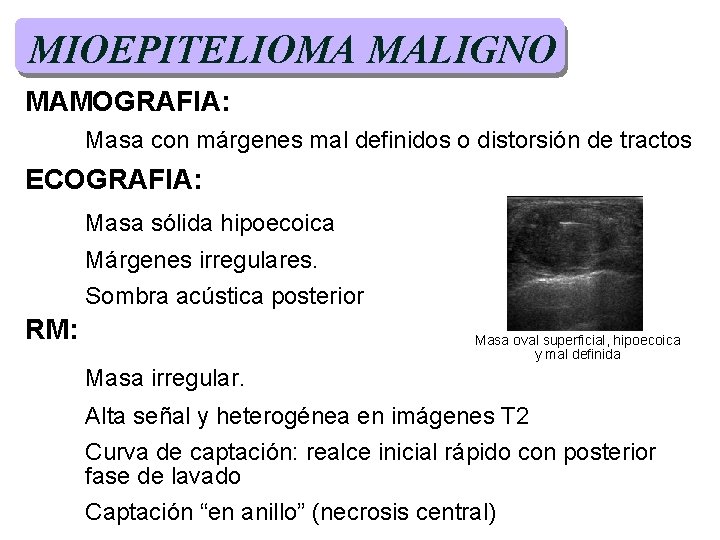 MIOEPITELIOMA MALIGNO MAMOGRAFIA: Masa con márgenes mal definidos o distorsión de tractos ECOGRAFIA: Masa MIOEPITELIOMA MALIGNO MAMOGRAFIA: Masa con márgenes mal definidos o distorsión de tractos ECOGRAFIA: Masa