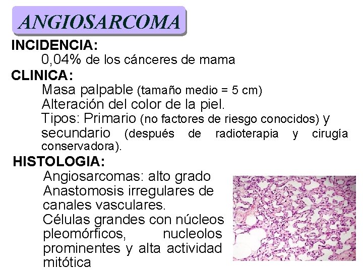 ANGIOSARCOMA INCIDENCIA: 0, 04% de los cánceres de mama CLINICA: Masa palpable (tamaño medio ANGIOSARCOMA INCIDENCIA: 0, 04% de los cánceres de mama CLINICA: Masa palpable (tamaño medio