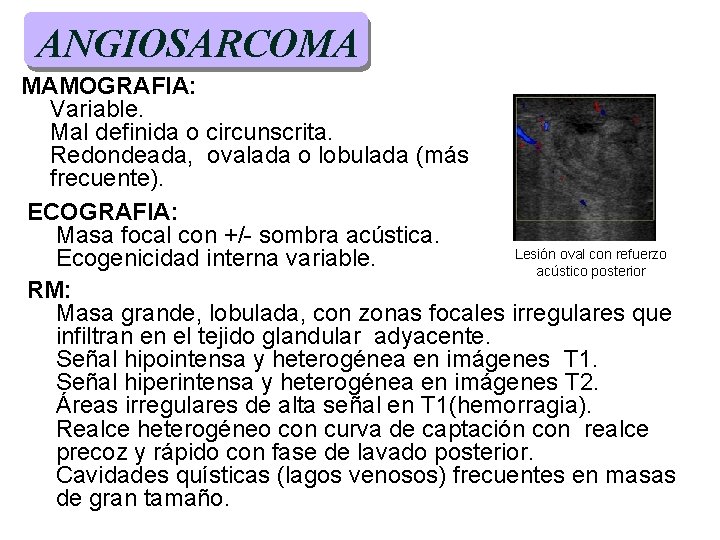 ANGIOSARCOMA MAMOGRAFIA: Variable. Mal definida o circunscrita. Redondeada, ovalada o lobulada (más frecuente). ECOGRAFIA: ANGIOSARCOMA MAMOGRAFIA: Variable. Mal definida o circunscrita. Redondeada, ovalada o lobulada (más frecuente). ECOGRAFIA: