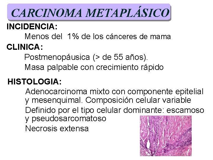 CARCINOMA METAPLÁSICO INCIDENCIA: Menos del 1% de los cánceres de mama CLINICA: Postmenopáusica (> CARCINOMA METAPLÁSICO INCIDENCIA: Menos del 1% de los cánceres de mama CLINICA: Postmenopáusica (>