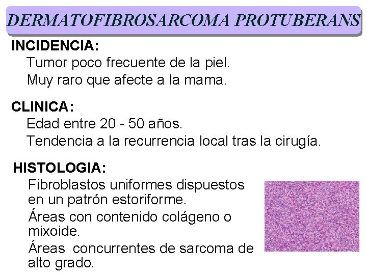 DERMATOFIBROSARCOMA PROTUBERANS INCIDENCIA: Tumor poco frecuente de la piel. Muy raro que afecte a DERMATOFIBROSARCOMA PROTUBERANS INCIDENCIA: Tumor poco frecuente de la piel. Muy raro que afecte a