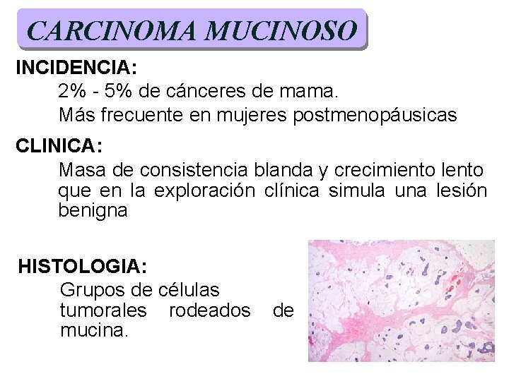 CARCINOMA MUCINOSO INCIDENCIA: 2% - 5% de cánceres de mama. Más frecuente en mujeres CARCINOMA MUCINOSO INCIDENCIA: 2% - 5% de cánceres de mama. Más frecuente en mujeres