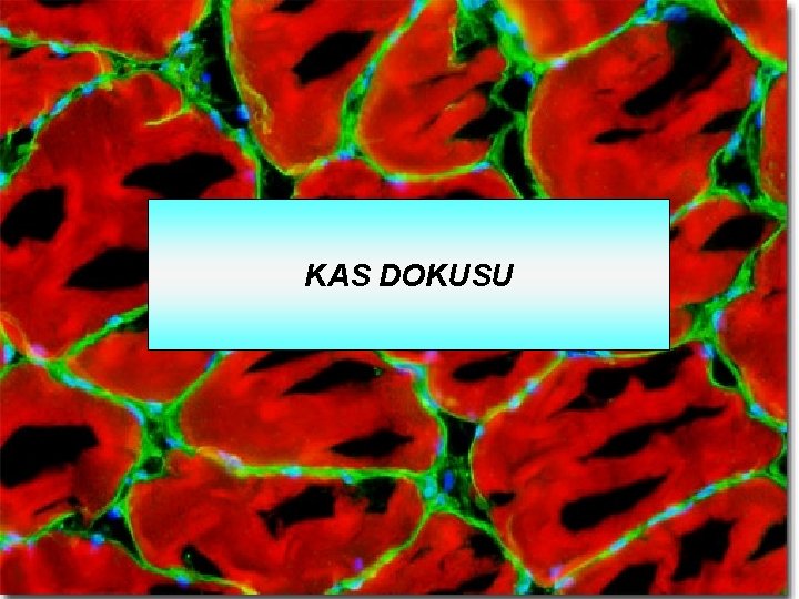 KAS DOKUSU 