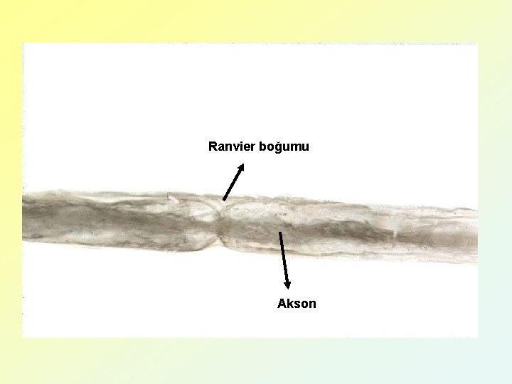 Ranvier boğumu Akson 