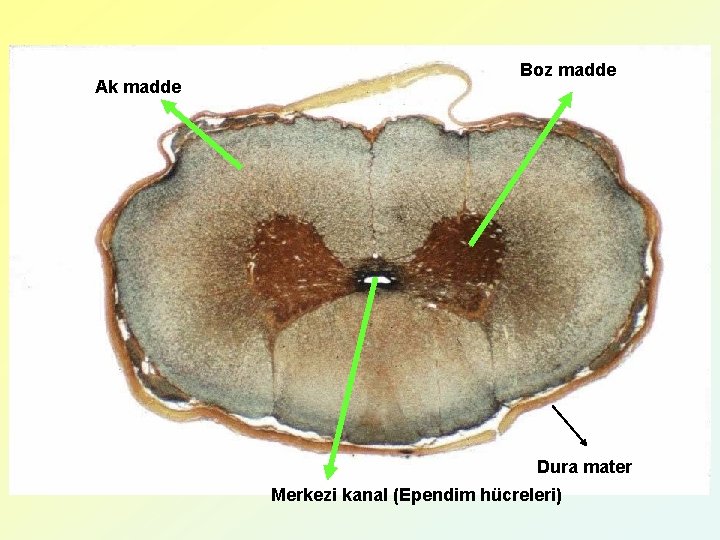 Ak madde Boz madde Dura mater Merkezi kanal (Ependim hücreleri) 