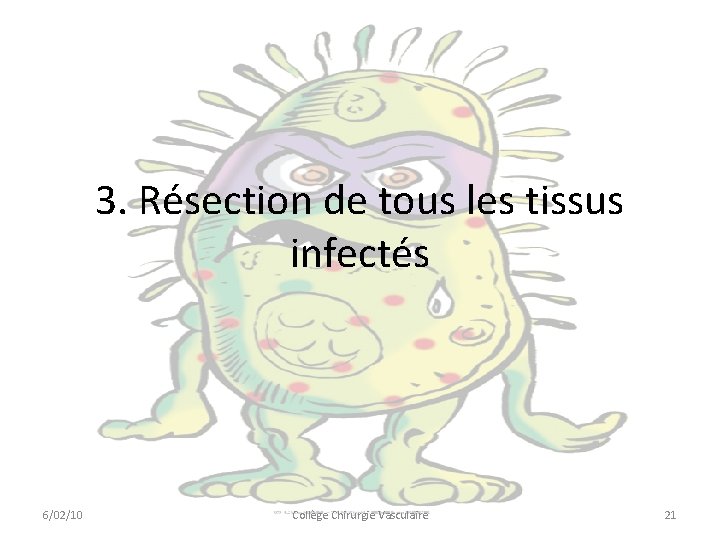 3. Résection de tous les tissus infectés 6/02/10 Collège Chirurgie Vasculaire 21 3. Résection de tous les tissus infectés 6/02/10 Collège Chirurgie Vasculaire 21