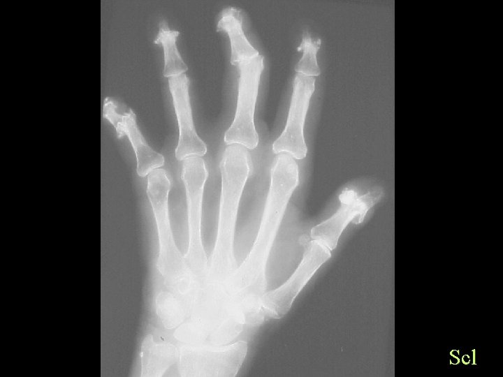 Scl 