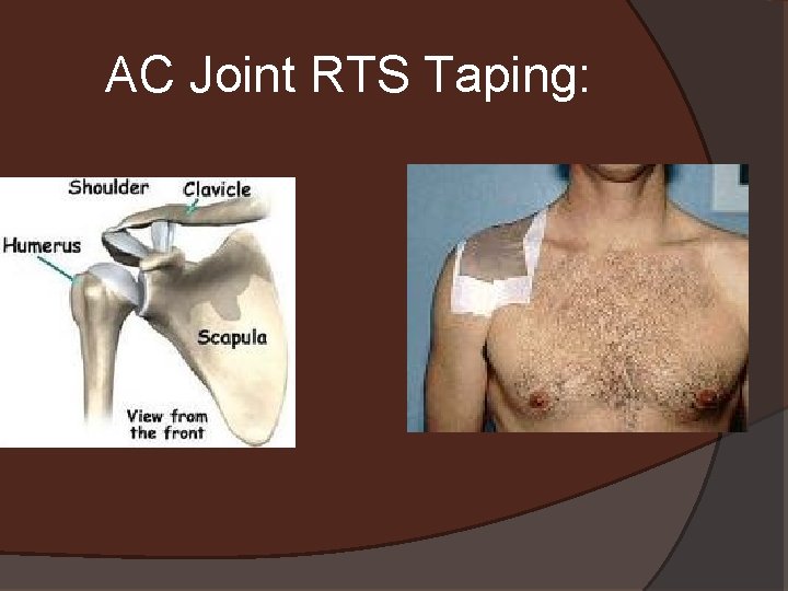 AC Joint RTS Taping: 