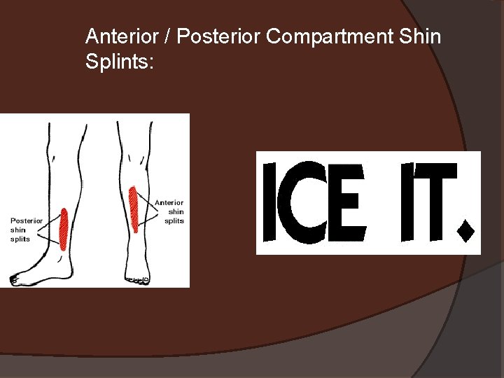 Anterior / Posterior Compartment Shin Splints: 