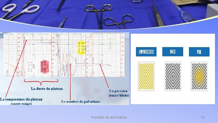 Procédés de stérilisation 11 